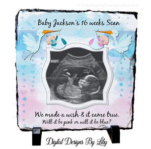BABY ULTRASOUND ANNOUNCEMENT SLATE